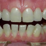 cosmetic-dentist-b-150x150