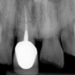 dental-implant-dentist-2-150x150