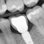 Dental-Implant-Dentist-in-Los-Angeles-150x150