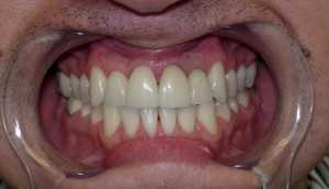 Dentist-in-Los-Angeles-300x172