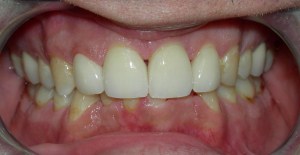 Cosmetic Dentistry